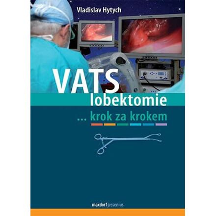 VATS lobektomie krok za krokem
