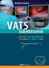 VATS lobektomie krok za krokem