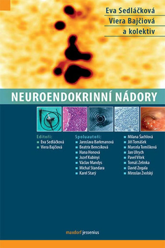 Neuroendokrinní nádory - Eva Sedláčková, Viera Bajčiová a kolektív - kniha z kategorie Onkologie