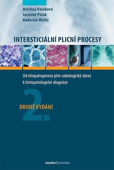 Intersticiální plicní procesy (2.vydání - Od etiopatogeneze přes radiologický obraz k histopatologické diagnóze) - kniha z kategorie Medicína