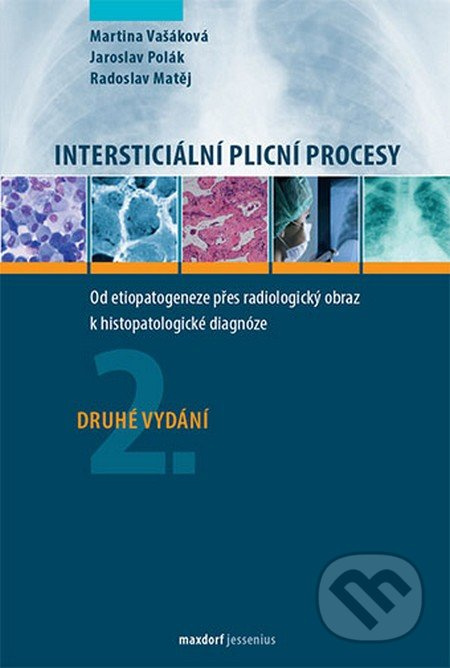Intersticiální plicní procesy (2.vydání - Od etiopatogeneze přes radiologický obraz k histopatologické diagnóze) - kniha z kategorie Medicína