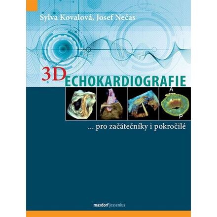 3D Echokardiografie