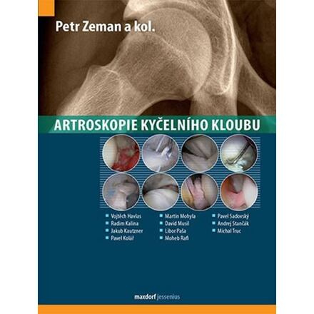Artroskopie kyčelního kloubu