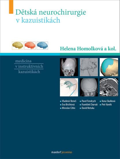 Dětská neurochirurgie v kazuistikách - Helena Homolková, kol.