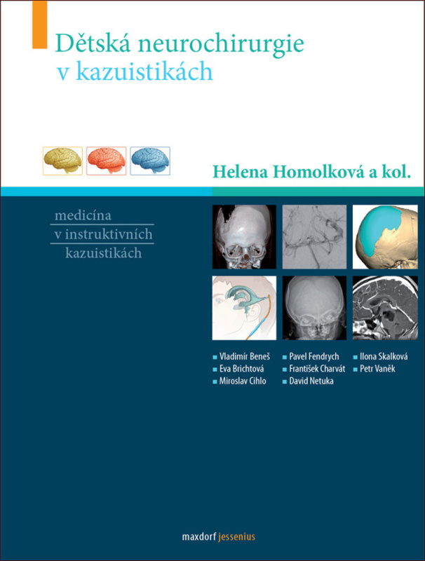 Dětská neurochirurgie v kazuistikách - Helena Homolková, kol.