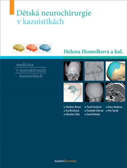 Dětská neurochirurgie v kazuistikách - Helena Homolková, kol.
