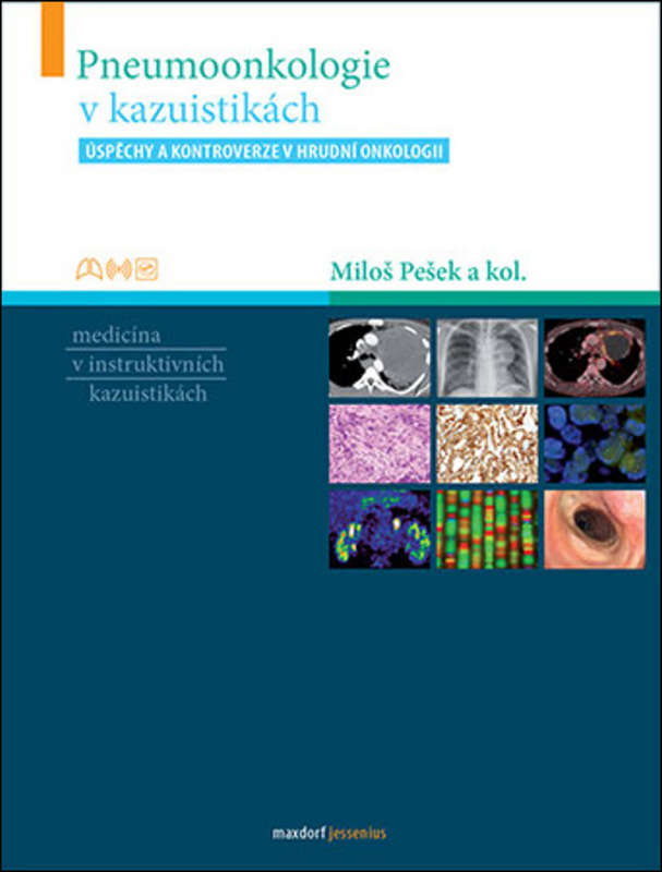 Pneumoonkologie v kazuistikách - Miloš Pešek, kol.