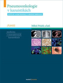 Pneumoonkologie v kazuistikách - Miloš Pešek, kol.