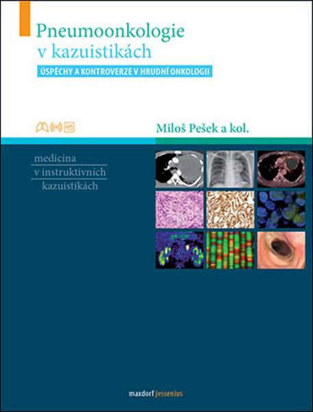 Pneumoonkologie v kazuistikách - Miloš Pešek, kol.