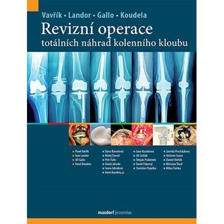 Revizní operace totálních náhrad kolenního kloubu - Pavel Vavřík, Ivan Landor, Jiří Gallo