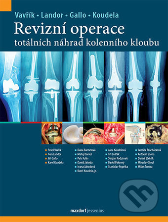 Revizní operace totálních náhrad kolenního kloubu - Pavel Vavřík, Ivan Landor, Jiří Gallo