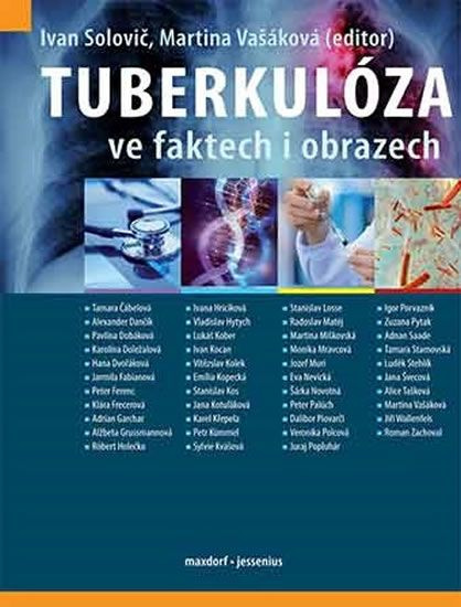 Tuberkulóza ve faktech i obrazech - Ivan Solovič, Martina Vašáková, kol.