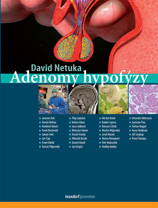 Adenomy hypofýzy - David Netuka, kol.