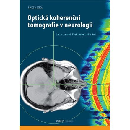 Optická koherenční tomografie v neurologii - Jana Preiningerová Lízrová, kol.