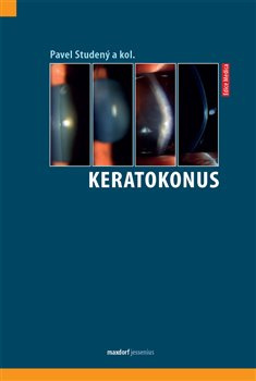Keratokonus - Pavel Studený, kol.
