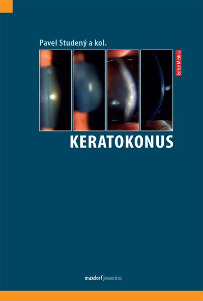 Keratokonus - Pavel Studený, kol.