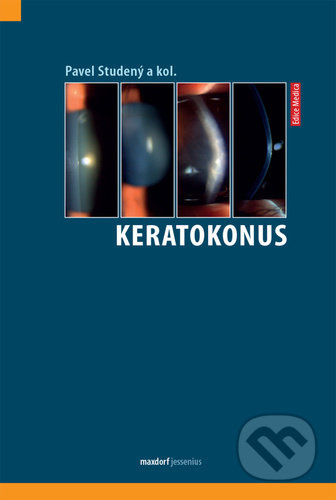 Keratokonus - Pavel Studený, kol.