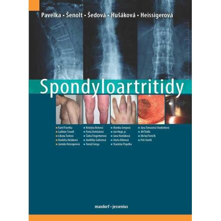 Spondyloartritidy - Karel Pavelka, kol., Ladislav Šenolt, Liliana Šedová, Markéta Hušáková, Jarmila Heissigerová