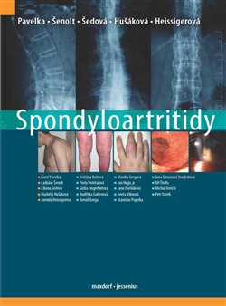 Spondyloartritidy - Karel Pavelka, kol., Ladislav Šenolt, Liliana Šedová, Markéta Hušáková, Jarmila Heissigerová