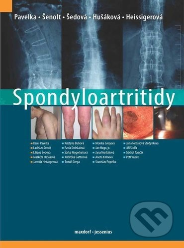 Spondyloartritidy - Karel Pavelka, kol., Ladislav Šenolt, Liliana Šedová, Markéta Hušáková, Jarmila Heissigerová