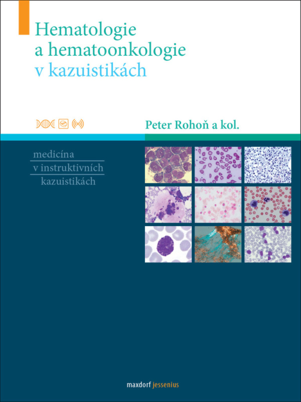 Hematologie a hemootonkologie v kazuistikách - Peter Rohoň, kol.