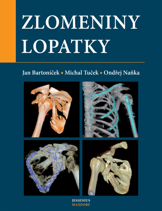 Zlomeniny lopatky - Michal Tuček, Ondřej Naňka, Jan Bartoníček