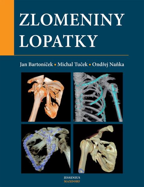 Zlomeniny lopatky - Michal Tuček, Ondřej Naňka, Jan Bartoníček