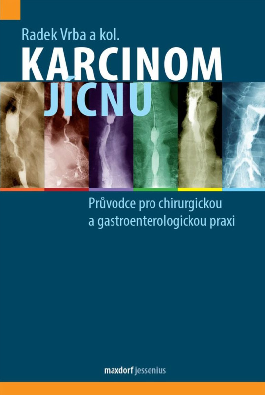 Karcinom jícnu - Radek Vrba, kol.
