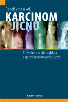Karcinom jícnu - Radek Vrba, kol.