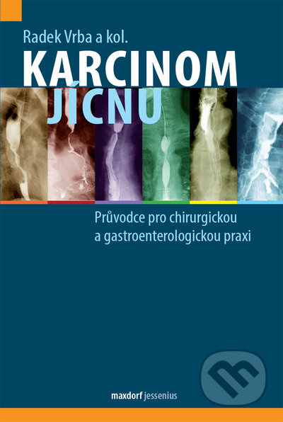 Karcinom jícnu - Radek Vrba, kol.