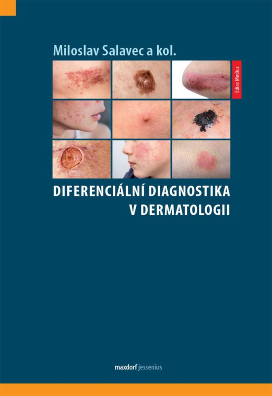 Diferenciální diagnostika v dermatologii - Miloslav Salavec, kol.