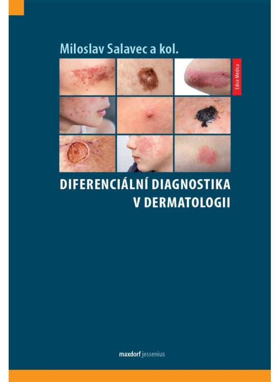 Diferenciální diagnostika v dermatologii - Miloslav Salavec, kol.