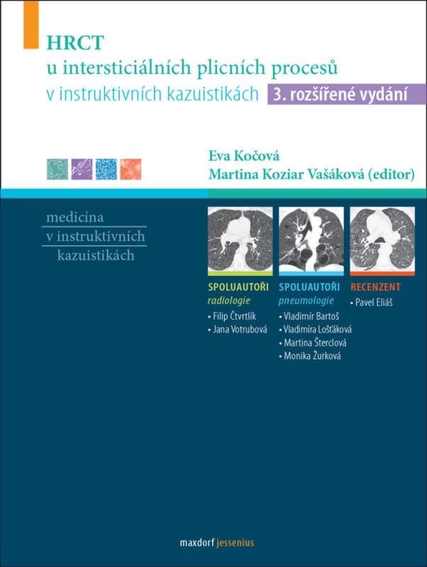 HRCT u intersticiálních plicních procesů v instruktivních kazuistikách - kol.