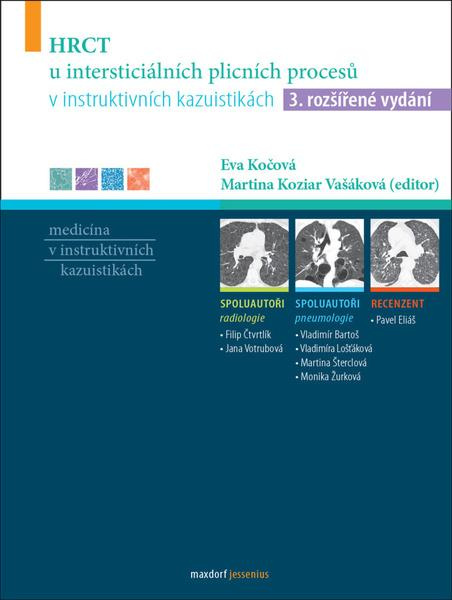 HRCT u intersticiálních plicních procesů v instruktivních kazuistikách - kol.