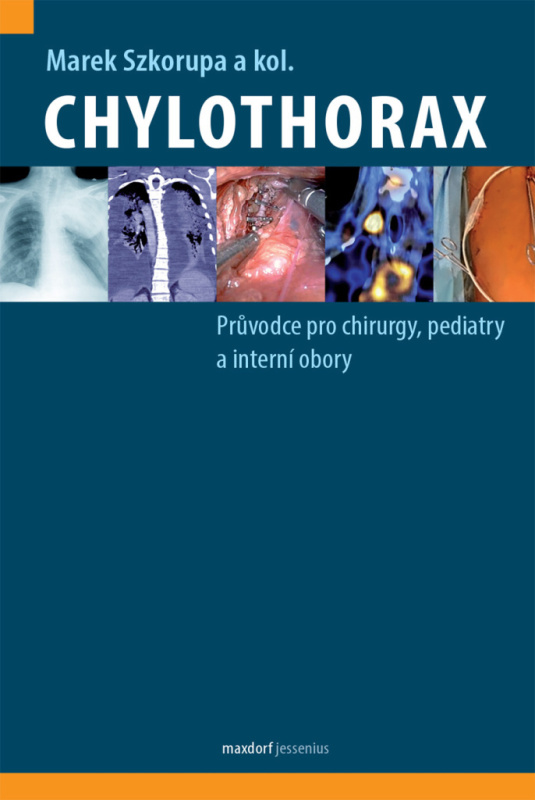 Chylothorax - Marek Szkorupa, kol.