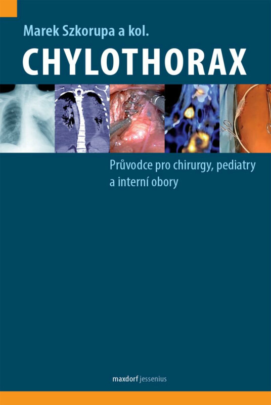 Chylothorax - Marek Szkorupa, kol.