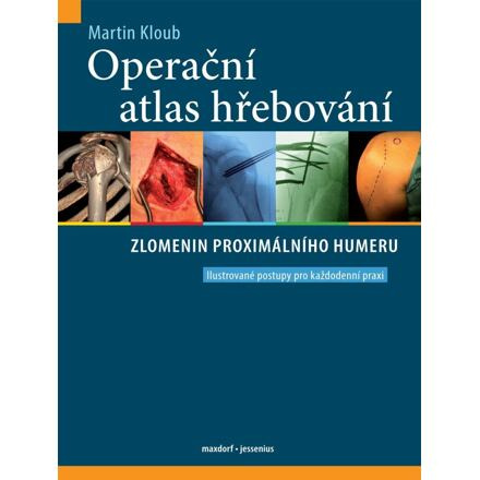 Operační atlas hřebování zlomenin proximálního humeru - Martin Kloub