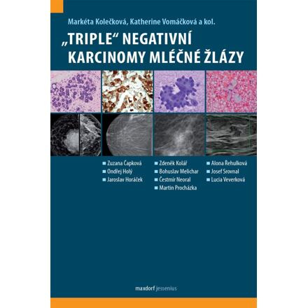„Triple“ negativní karcinomy mléčné žlázy - Markéta Kolečková