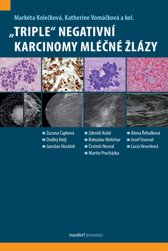 „Triple“ negativní karcinomy mléčné žlázy - Markéta Kolečková