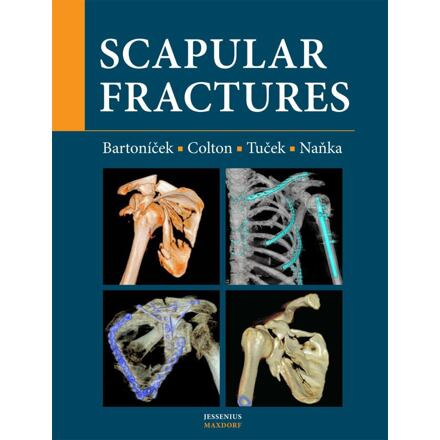 Scapular fractures - Jan Bartoníček, Christopher Colton, Michal Tuček, Ondřej Naňka