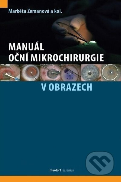 Manuál oční mikrochirurgie v obrazech - Markéta Zemanová, kol.