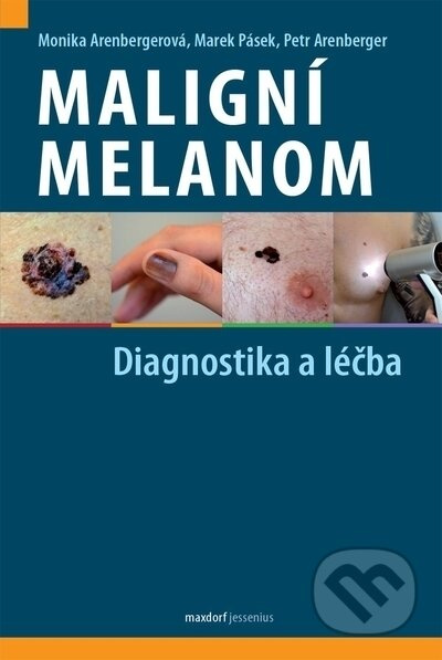 Maligní melanom (Diagnostika a léčba) - Monika Arenbergerová, Marek Pásek, Petr Arenberger - kniha z kategorie Dermatologie