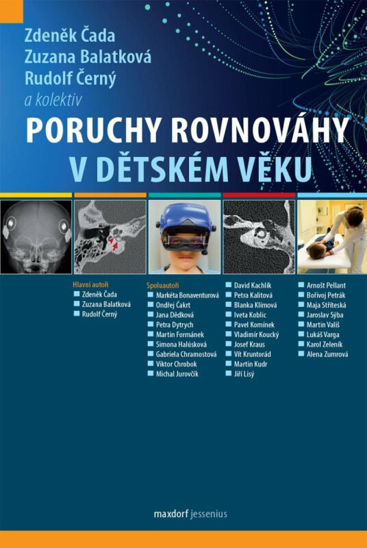 Poruchy rovnováhy v dětském věku - Zdeněk Čada
