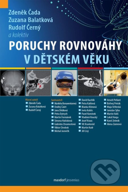 Poruchy rovnováhy v dětském věku - Zdeněk Čada
