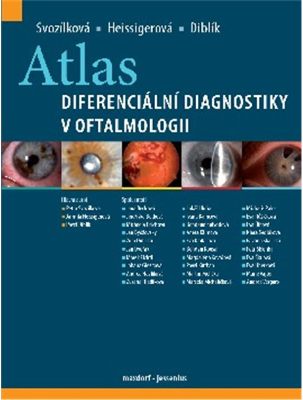 Atlas diferenciální diagnostiky v oftalmologii -  MUDr. Pavel Diblík