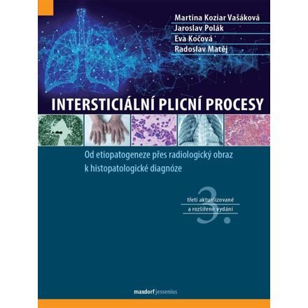 Intersticiální plicní procesy - kol.