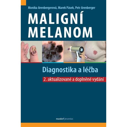 Maligní melanom – Diagnostika a léčba - Petr Arenberger, Monika Arenbergerová, Marek Pásek
