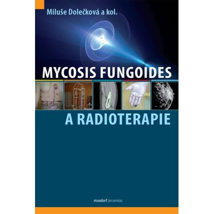 Mycosis fungoides a radioterapie - Miluše Dolečková, kol.
