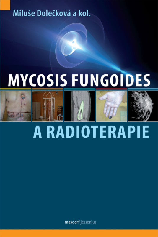 Mycosis fungoides a radioterapie - Miluše Dolečková, kol.