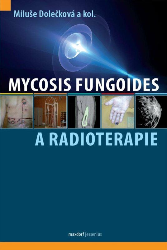 Mycosis fungoides a radioterapie - Miluše Dolečková, kol.